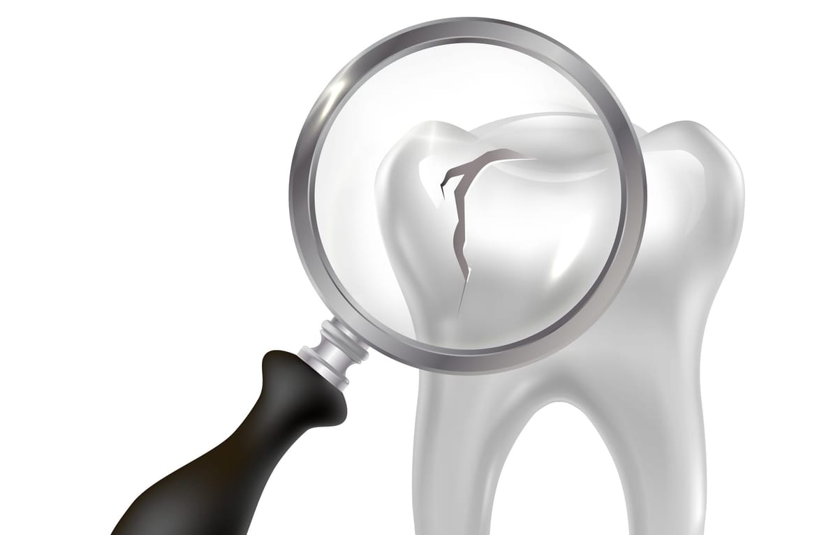 Exercice physique et oméga-3 : une approche prometteuse contre les infections dentaires