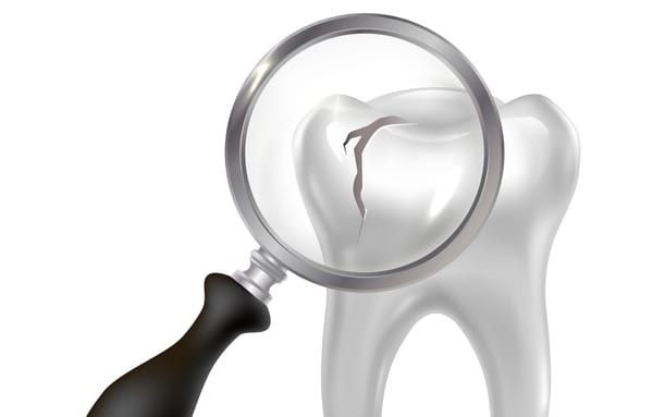 Exercice physique et oméga-3 : une approche prometteuse contre les infections dentaires